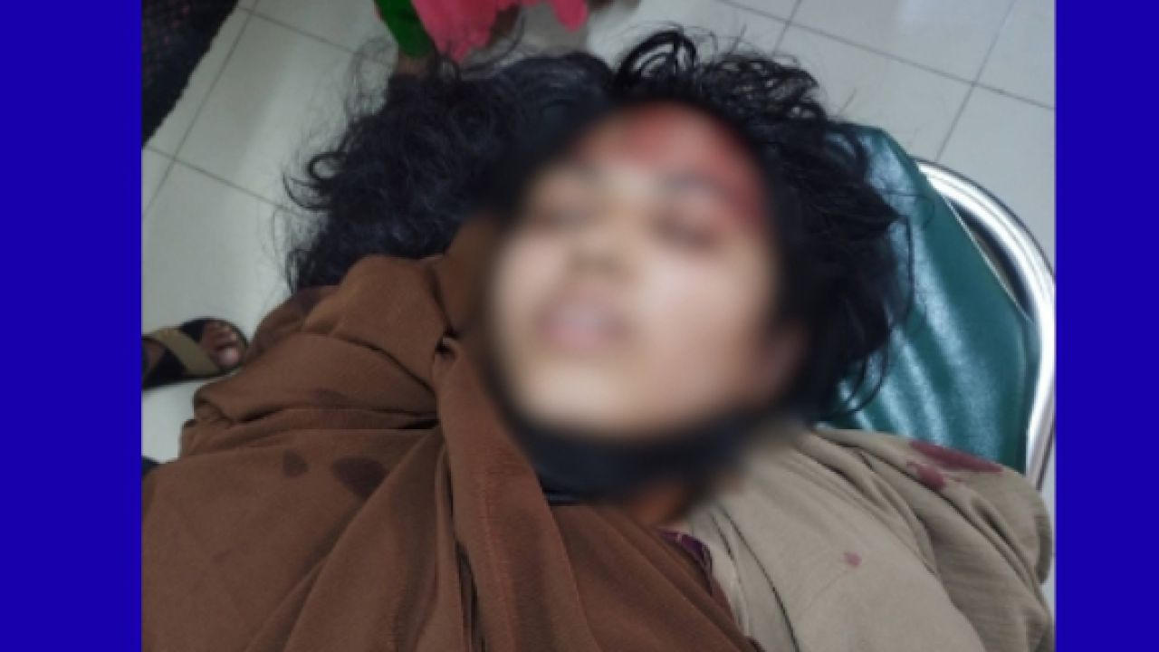 পদুয়ায় বাইকের ধাক্কায় চবি ছাত্রীর পা বিচ্ছিন্ন