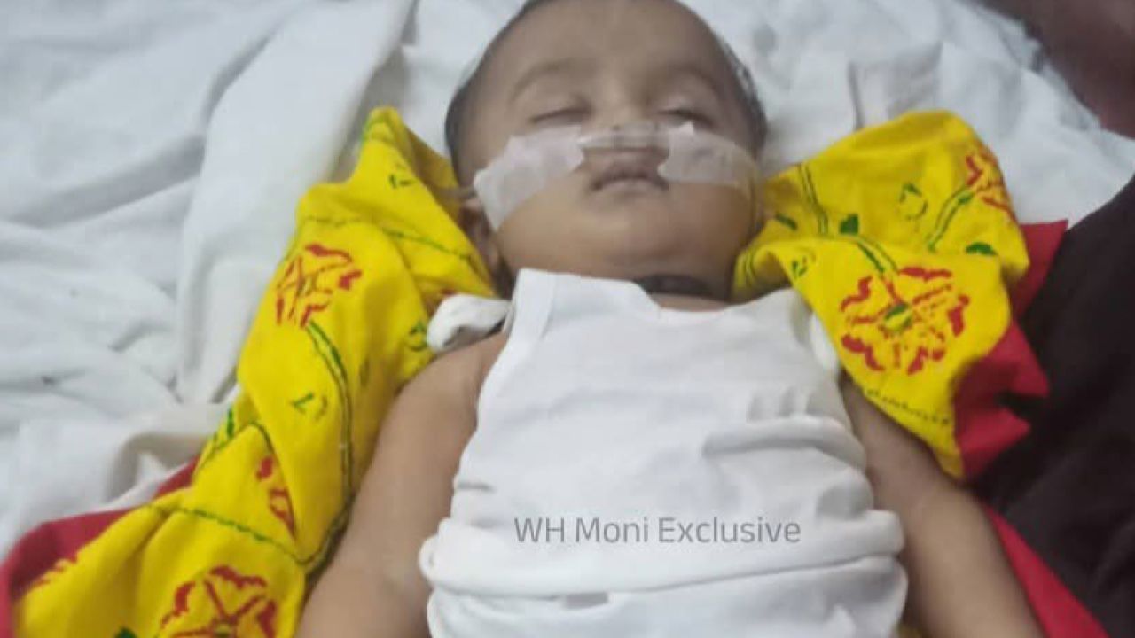 মহেশখালীতে হামের ভয়াবহতা: আইসিইউতে লড়াই শেষে শিশুর মৃত্যু, বাড়ছে আতঙ্ক