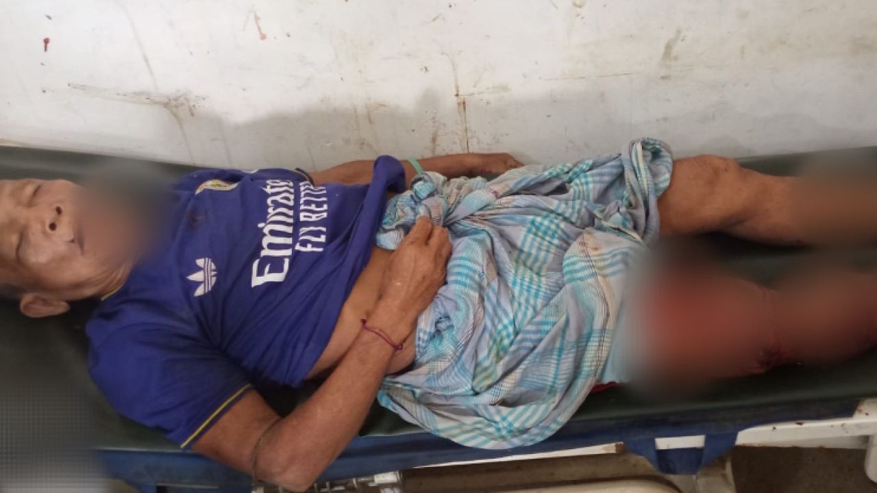 আলীকদমে মোটরসাইকেল নিয়ন্ত্রণ হারিয়ে নিহত ১, আহত ২