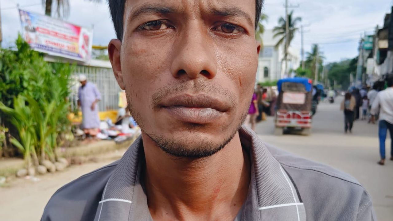 লামায় ​পাওনা টাকা চাওয়ায় হামলা ও ছিনতাইয়ের অভিযোগ উঠেছে 
